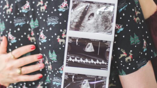 couple hugging and holding ultrasound of baby